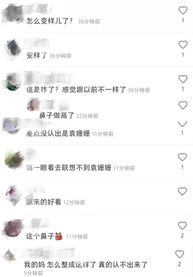 袁姗姗整容成功吗，袁姗姗晒原相机怼脸自拍