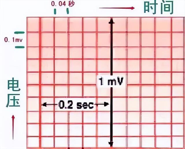 一分钟快速看懂心电图，1分钟教你看懂心电图