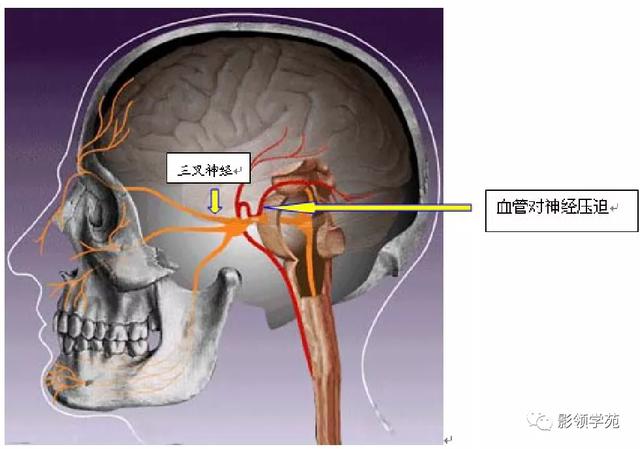 面部血管分布图，三叉神经分支及面部分布规律（玻尿酸怎么打，才会避免栓塞呢）