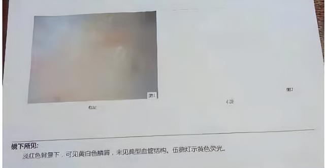 脚气止痒的方法小妙招快速，脚气难耐奇痒无比