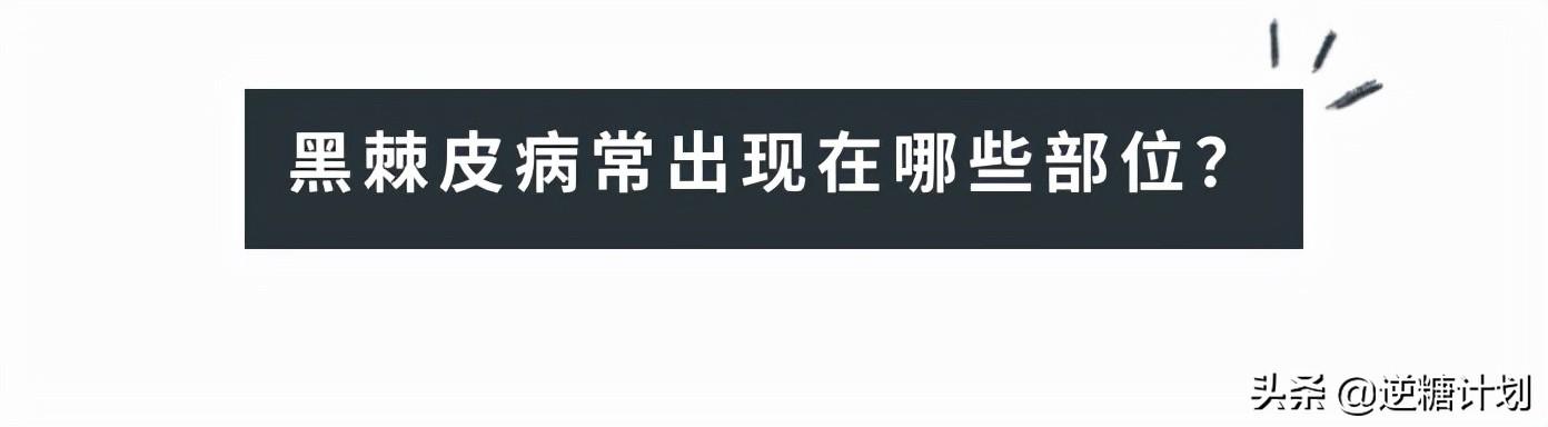 皮肤出现褐色斑块，皮肤突然出现褐色斑块