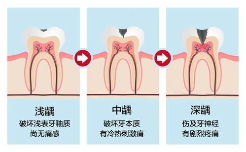 补牙流程详解，关于补牙的攻略指南