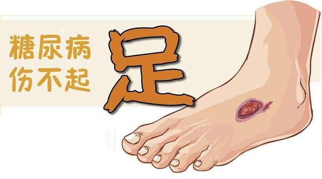 糖尿病足的护理诊断(糖尿病足的护理措施包括哪些内容)
