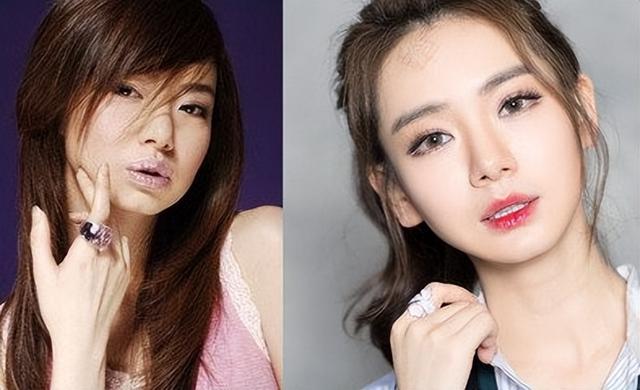 整容失败的明星，整容失败最严重的明星