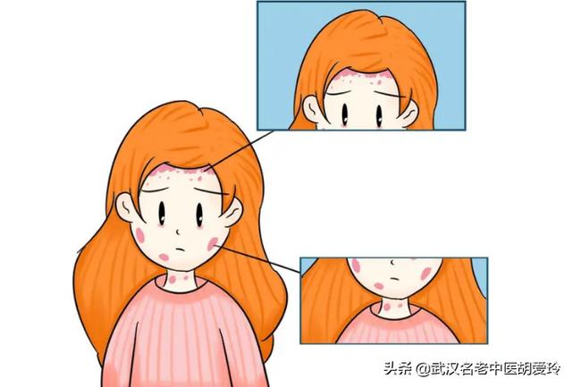 肥胖脱皮(肥胖导致皮肤裂开)