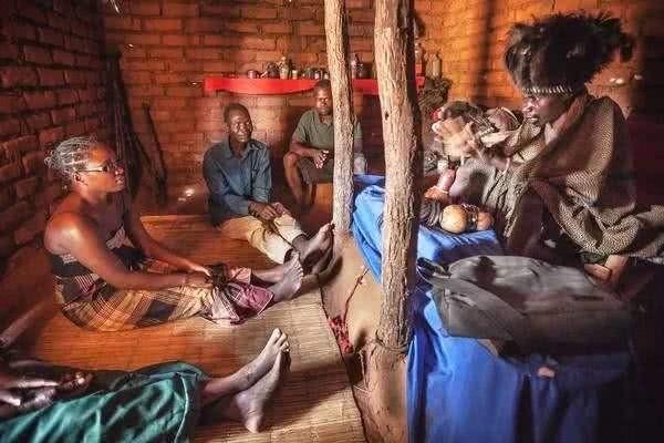 人类白化病的直接原因，非洲的白化病人