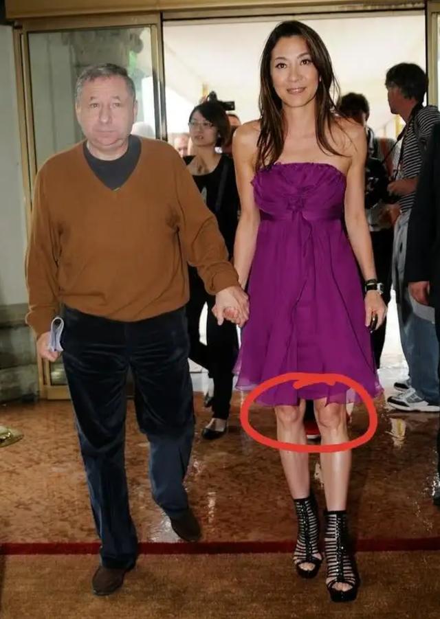 杨紫琼晚年生活，杨紫琼膝盖变形