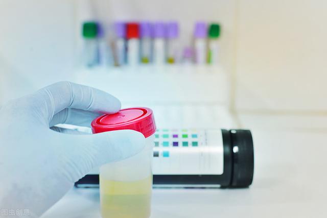 尿常规化验单咋样看，轻松读懂尿常规化验单