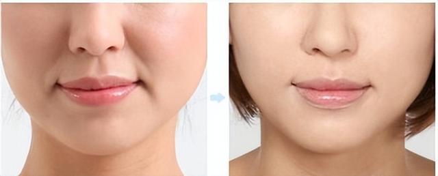 娃娃脸和瓜子脸的区别，为什么有的娃娃脸老了还显年轻