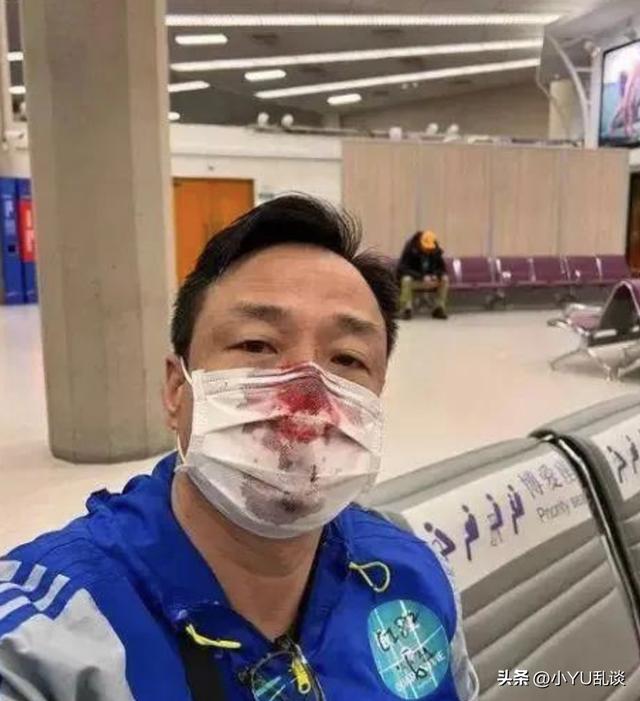 风云雄霸天下秦霜断手，《风云》雄霸曾把聂风、步惊云、秦霜打残