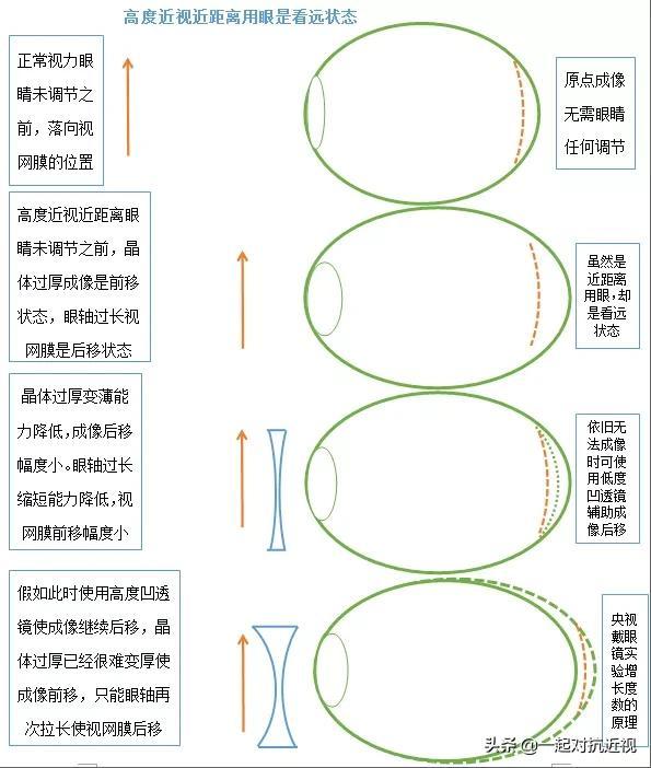 眼睛的成像原理示意图，眼睛所有成像过程一览