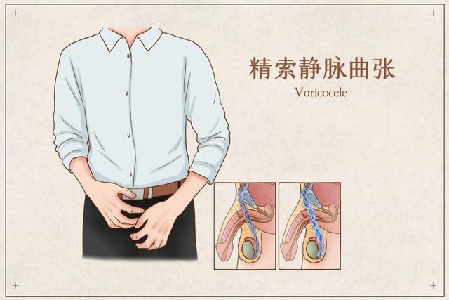 男人常见十大疾病，男性一生中最常见的五种疾病