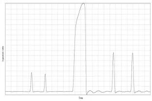 压电式共轨系统，高压共轨系统介绍-LIEBHERR