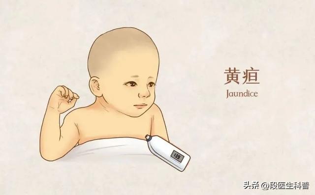 肥胖黄疸(有黄疸是不是孩子体重长得慢)