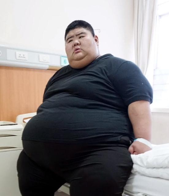 肥胖丈夫苗条(瘦丈夫胖妻子)
