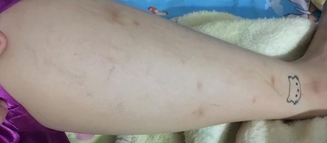 泰国青草膏的功效和作用，泰国卡瓦库德青草薄荷膏