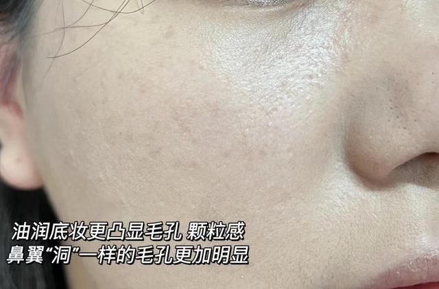 缩毛孔最有效方法，收缩毛孔最好的方法