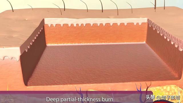 皮肤组织结构图，皮肤组织示意图讲解