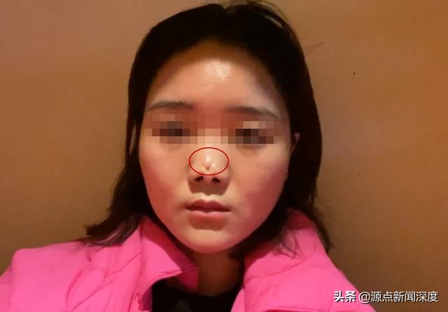 肋骨脂肪肥胖(胖了肋骨会不会变顶起来)