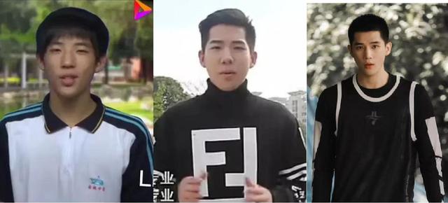 换脸成功的人，顶着“面具脸”41年苦不堪言