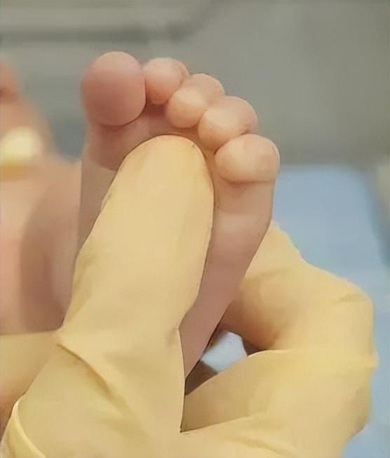 怎么判断宝宝大脑发育好不好，宝宝越早出现这个动作