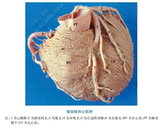冠状动脉肌桥属于先天性疾病吗，冠状动脉肌桥属于什么病