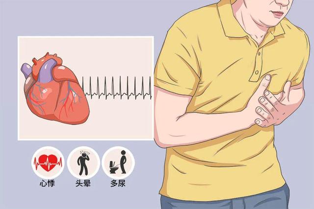 窦速糖尿病(糖尿病窦性心律过速)