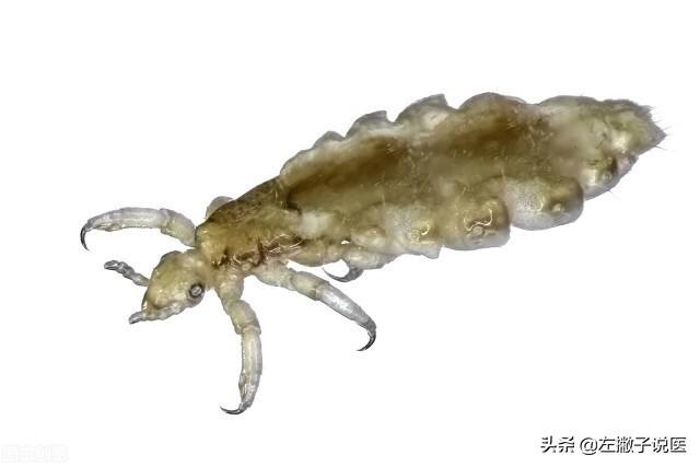 30年前常见的虱子，30年前农村男女身上几乎都有