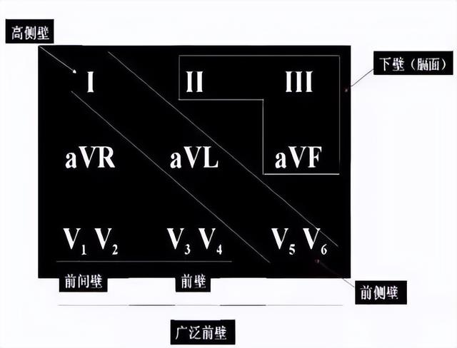 一分钟快速看懂心电图，1分钟教你看懂心电图