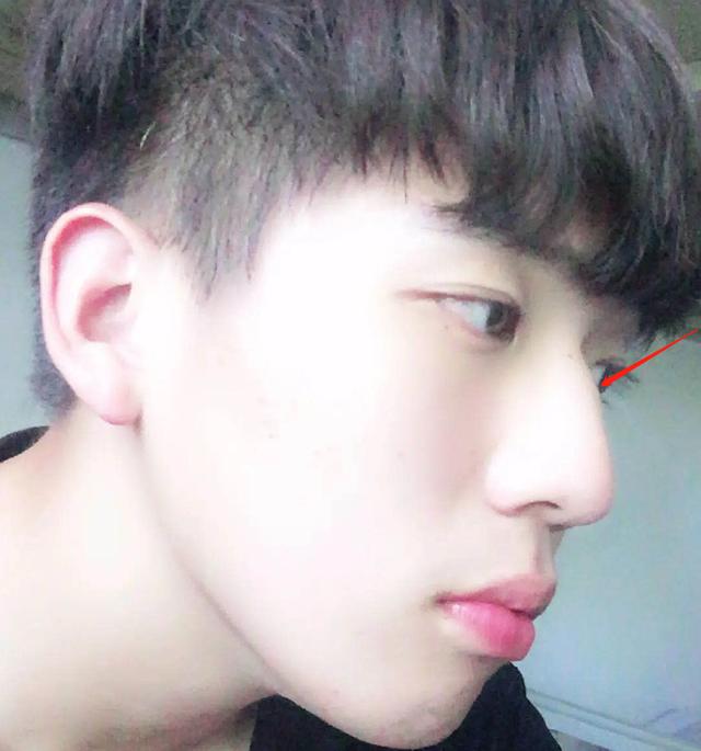 换脸成功的人，顶着“面具脸”41年苦不堪言