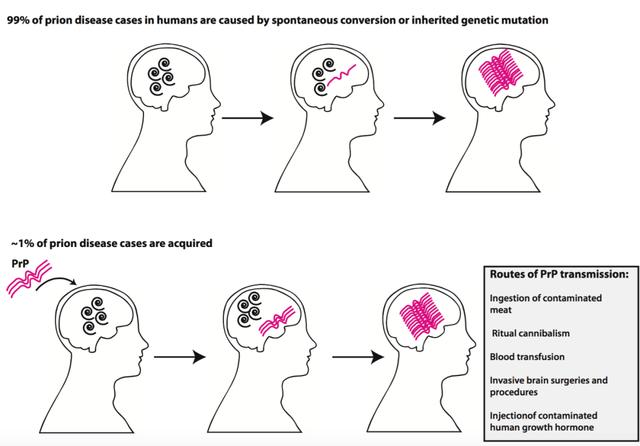 致死率达100烹煮都杀不死的朊病毒，朊病毒到底是什么病毒