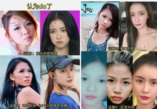 换脸成功的人，顶着“面具脸”41年苦不堪言