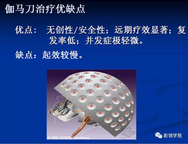 面部血管分布图，三叉神经分支及面部分布规律（玻尿酸怎么打，才会避免栓塞呢）