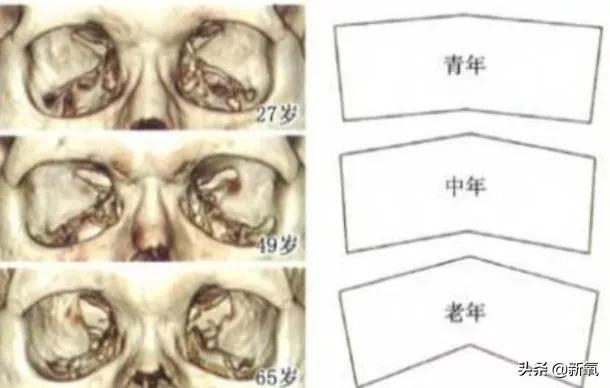 眼睛构造详细图解，人体解剖：眼睛及常见疾病