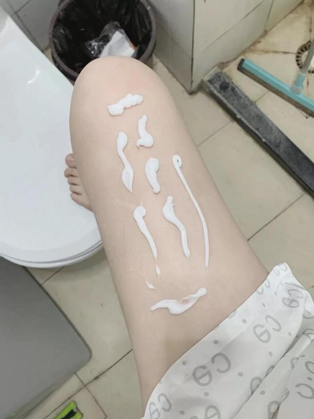 去肥胖纹药膏(去肥胖纹药膏肝什么素)