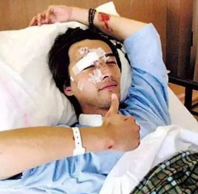 胡歌车祸后复出的样子，胡歌车祸毁容女助理离世