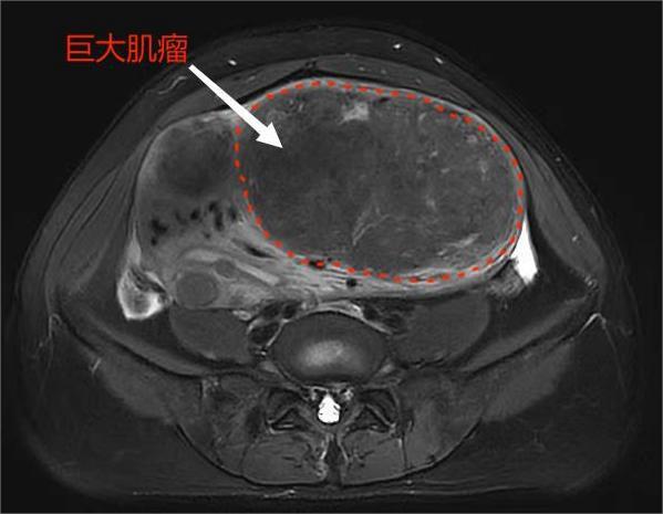 肥胖女人大肚腩视频(肥胖女人大肚腩图片)