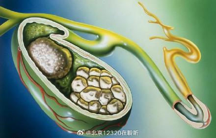 石头糖尿病(糖尿病石斛的功效与作用)