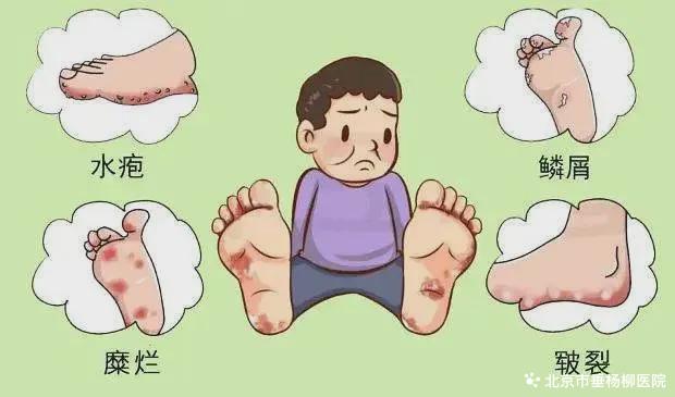 糖尿病足足部检查(糖尿病足检查内容包括)