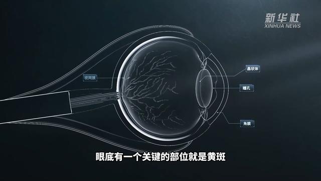 糖尿病内眼角(糖尿病内眼角血管明显图片)