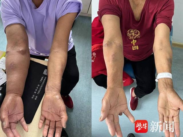 肥胖的大脸(大胖脸是什么意思)