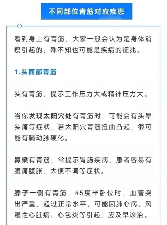 做梦开车撞死人(做梦开车撞死人了是什么征兆)插图1