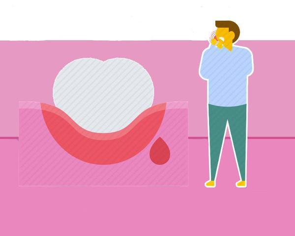 肝病来临前有什么征兆，肝脏好不好一看便知