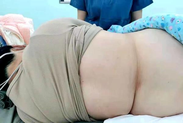 肥胖怀双胎(肥胖怀双胎有什么危害)