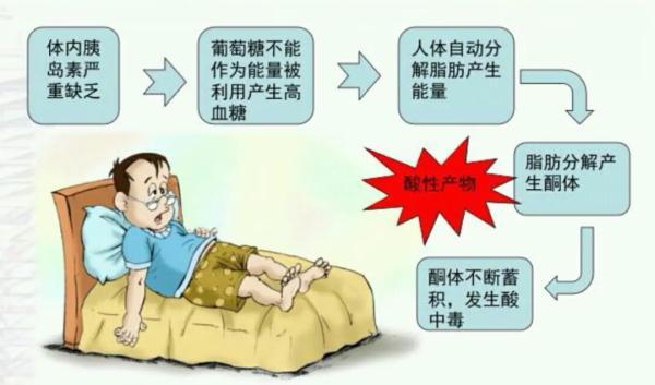 阳后糖尿病(阳后糖尿病能恢复吗)