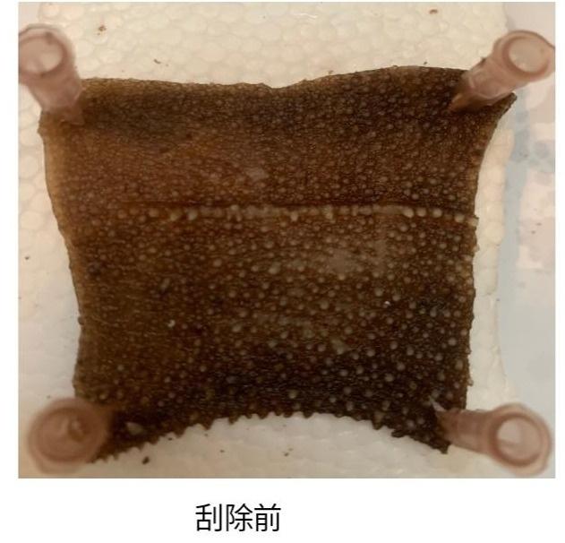 腋臭微创手术器具(腋臭微创手术是什么原理)