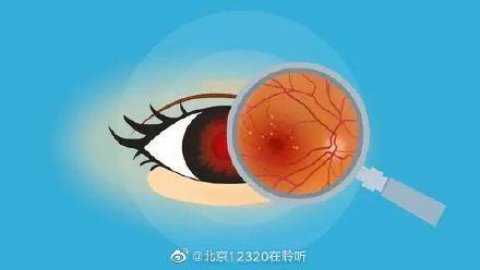 糖尿病视网膜发生病变(糖尿病视网膜发病率)