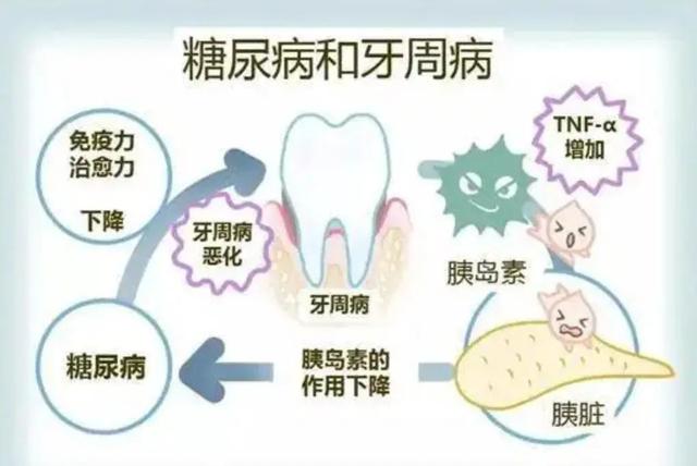 牙酸是糖尿病吗(牙酸是坏了吗)
