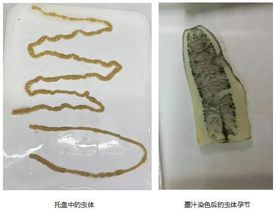 绦虫 肥胖(绦虫对身体好不好)