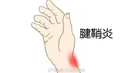 糖尿病会手疼吗(糖尿病会引起手指疼吗)
